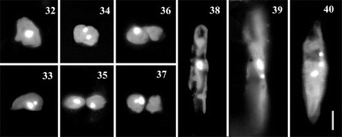 Figs 32 – 40. Auxosporulating cells of clone C stained with DAPI. Figs 32 – 37. Variation at early stages, before expansion into auxospore, associated with a single division of nucleus. Fig. 32. Before division of the nucleus. Figs 33 – 35. Division of the nucleus in an undivided protoplast. There are two possibilities: either one of the two products quickly aborts (Fig. 33) or both the nuclei survive (Fig. 34), in which case cytokinesis follows (Fig. 35). Figs 36, 37. Division of the nucleus after cytokinesis: the cell contents divide first (Fig. 36) and then karyokinesis occurs, accompanied by abortion of one of the two products (Fig. 37). Fig. 38. Developing auxospore containing a single nucleus. Figs 39 – 40. Expanded auxospores, after the first, Fig. 39, and the second, Fig. 40, acytokinetic mitotic divisions that precede formation of the epi- and hypothecae of initial cell. Scale bar (for all) represents 10 μm.