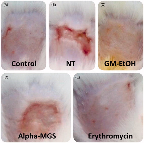 Figure 7. The effect of GM-EtOH and α-mangostin on the wound-appearance. The photograph of the wound was recorded daily (n = 7–10) after the treatments. The figure showed the wound-appearance on the last day of observation (the ninth day). Control, non-infected mice with the tape stripping induced wound; NT, MRSA-infected wound in mice with no treatment; GM-EtOH, MRSA-infected wound in mice treated with 100 μL of a 10% GM-EtOH in a 10% ethanol in propylene glycol solution; Alpha-MGS, MRSA-infected wound in mice treated with 100 μL of a 1.32% α-mangostin in a 10% ethanol in propylene glycol solution; Erythromycin, MRSA-infected wound in mice treated with 100 μL of a 1.32% erythromycin in a 10% ethanol in propylene glycol solution.