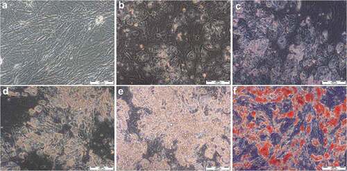 Figure 3. Accumulation of lipid droplets over the time of adipogenic differentiation in DM visualized by light microscopy (20x magnification, scale bar: 100 µm). (a) undifferentiated adipose-derived stem cells (hASC) 7 days after isolation; (b–e) 7, 14, 21 and 28 days after differentiation was induced; (f) Oil-Red-O stained cells, 28 days after differentiation was induced.