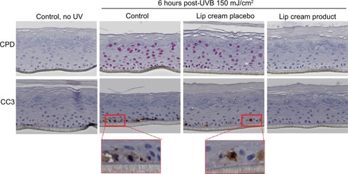 Figure 3 Lip cream with UV filters inhibited UVB-induced DNA damage (CPD, pink staining) and apoptosis (CC3, brown staining) in EpiDerm.