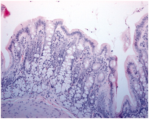 Figure 5. Hematoxylin and eosin staining of intestine tissue sections (200×) of Poly-[SFHb-SOD-CAT-CA] reperfusion after 90 min ischemia and 1 h resuscitation.