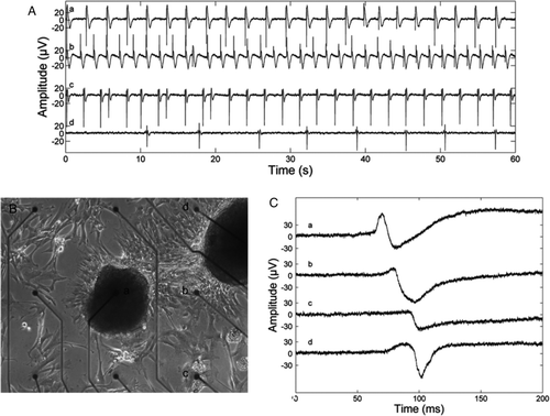 Figure 3.  A: A Microelectrode array-recording recording of isoprenaline and esmolol effects. Signal a: no treatment, average beating rate (ABR) 24 beats/min; b: 0.017 µg/mL isoprenaline, ABR 36 beats/min; c: 0.017 µg/mL isoprenaline and 14.3 µg/mL esmolol, ABR 24 beats/min; and d: 0.017 µg/mL isoprenaline and 25.0 µg/mL esmolol, ABR 6 beats/min. With both 0.017 µg/mL isoprenaline and 25.0 µg/mL of esmolol in the medium, clear beating was observed at only one microelectrode, whereas in the other cases beating was recorded via six or seven electrodes. All beat rates differed statistically significantly form each other (P < 0.001), and the beat rates observed during treatment were statistically significantly different from the beat rate without treatment by P < 0.0001, as given by the two-sample t test. B and C: An example of conduction of electrical activation in an HS346-derived cardiomyocyte culture. B: A microscope image of a part of the culture and nine microelectrodes. The inter-electrode distance is 500 µm and electrode diameter 30 µm. C: Single beats recorded via the electrodes a, b, c, and d, marked in B. The electrical activation is conducted from cells near the electrode a, via the vicinity of the electrode b, to cells near the electrodes c and d. The signals seen in A and C were low-pass filtered in Matlab (The MathWorks, Inc., Natick, MA, USA) with a passband end frequency of 100 Hz for plotting.