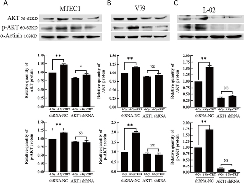 Figure 5 The impact of AKT knockdown on the effects of TRT on p-AKT and total AKT levels. The p-AKT and AKT levels in MTEC1 (A), V79 (B), and L-02 (C) cells in the 6 Gy and 6 Gy+TRT groups were assessed by Western blotting, and results were analyzed by GraphPad Prism 8. *P < 0.05, **P < 0.01.