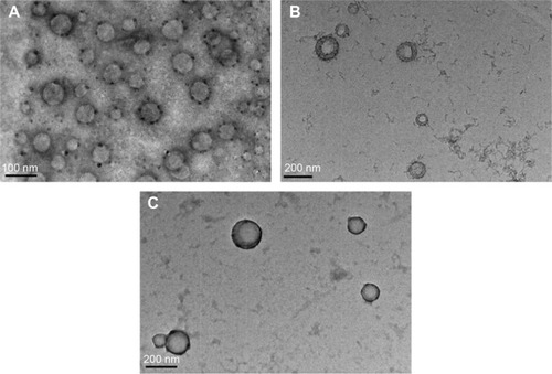 Figure 3 Transmission electron microscopy images of free PLGA NPs (A); PCP NPs (B), and PCPH NPs (C).Abbreviations: PLGA, polylactic-co-glycolic acid; NPs, nanoparticles; PCP, PLGA/cetylated polyethyleneimine; PCPH, PCP/hyaluronic acid.