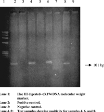 Figure 1. Ethidium bromide stained agarose gel electrophoresis of RT-PCR product of HGV RNA showing desired amplicon of 101 bp.