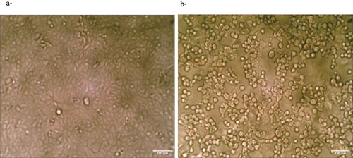 Figure 2. (a) Control untreated Vero cells. (b) Cells after 3 days of treatment with 1000 µg/mL κ.