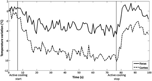 Figure 4. Effect of water cooling: MR thermometry in the focal and cortex planes.