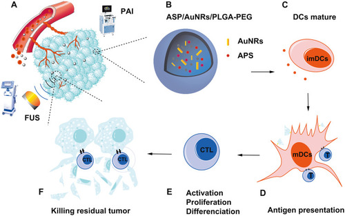 Figure 1 (A) Schematic illustration of the theranostic functions of as-synthesized APS/AuNR/PLGA-PEG NPs, including their passive accumulation in tumor tissue via the typical EPR effect followed by PA imaging and FUS ablation of the tumor. (B) Schematic illustration of the synthetic procedure of APS/AuNRs/PLGA-PEG. (C) Coaction of immature DCs with APS. (D) Mature DCs identify antigen information and transmit it to T cells. (E) T cell activation, proliferation and differentiation to antigen-specific CTLs. (F) CTLs infiltrate into the tumor and kill the residual tumor.Abbreviations: APS, astragalus polysaccharide; AuNRs, gold nanorods; PLGA, poly(lactic-co-glycolic) acid; PEG, polyethylene glycol; NPs, nanoparticles; PAI, photoacoustic imaging; FUS, focused ultrasound; CTLs, cytotoxic T lymphocytes; DCs, dendritic cells; mDCs, mature DCs; imDCs, immature DCs.