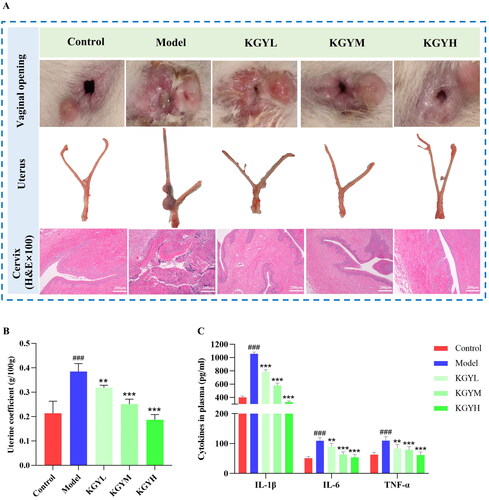 Figure 2. KGY improves cervical tissue congestion, edema, and inflammatory cell infiltration in cervicitis rats, and decreased plasma levels of inflammatory factors, including IL-6, IL-1β and TNF-α. (A) Effects of KGY on cervical tissue of rats (vaginal opening and uterus). (H&E staining images, original magnification, ×100). (B) Uterine coefficient of rats (n = 6). (C) Cytokines in plasma (n = 6). The model group is compared with the control group, ###p < 0.001; the KGY (low/medium/high dose) groups were compared with the model group, **p < 0.01 and ***p < 0.001.