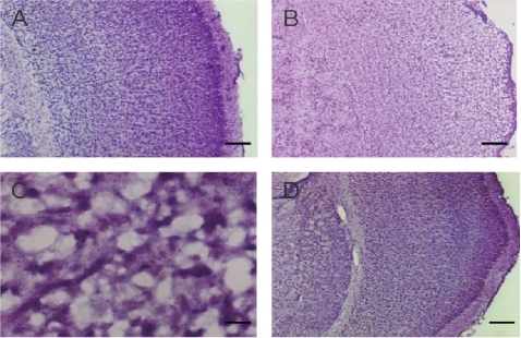 Figure 2 Photomicrographs of Nissl’s staining of the left cerebral cortex. A. A normal imaging from a sham-operated control. B. The regular architecture was destructed in the HI cortex. C. A high power view of the HI cortex, which shows necrosis of the cells with shrinkage of the cell body, pyknosis of nucleus, loss of Nissl substance, and disappearance of nucleolus. D. An imaging of the cortex from a subject received LTG of 40 mg/kg, 3 h after HI. Scale bar = 250 μm in A, B and D, and 25 μm in C.