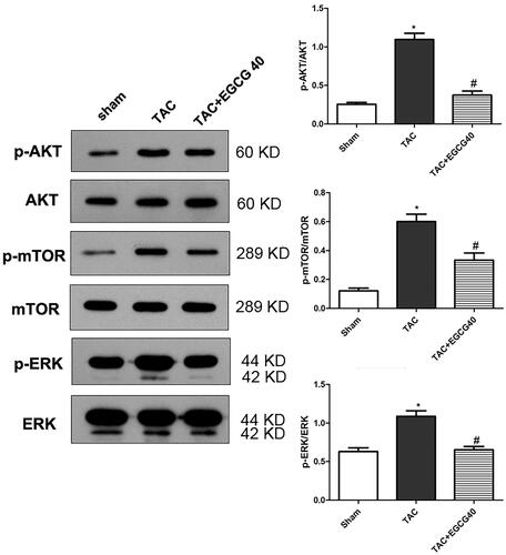 Figure 6. EGCG attenuates the activation of AKT/mTOR signalling and ERK1/2 phosphorylation in mice with TAC. *p < 0.05 as compared with the sham group. #p < 0.05 as compared with the TAC group.