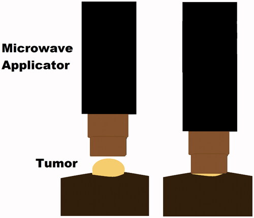 Figure 3. The microwave applicator used for tumour treatments consist of an open-ended pair of coaxial conductors, which was driven by a 915 MHz microwave generator, cooled by circulating water and sized to fit over the flank tumour of the mice. Tissue-applicator coupling gel was placed between the applicator and the tumour surface. Tumour temperatures and core temperature of the mice were measured throughout the treatment, with thermal history (CEM) calculated in real-time.