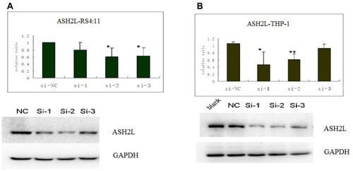 Figure 3 ASH2L levels were analyzed by Western blotting in RS4:11 and THP-1 cell lines after siRNA interference. The protein level of ASH2Lin sample No. 1 and 2 of THP-1 cells and sample No. 2 and 3 of RS4:11 cells were lower than that of the negative control group. (A) Expression in RS4:11 cells; (B) expression in THP-1 cells. Upper: column chart; Lower: electrophoresis map, ASH2L (Si-1: 741 bp, Si-1: 1412 bp, Si-1: 1664 bp). Western Blot Statistics (*P < 0.05, **P < 0.01).