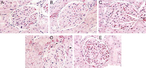 Figure 3. Effect of high-salt diet on kidney histopathology (H & E stain, 400× magnification). (a) CON, no histopathologic lesions are seen. (b) RS4, hyaline matrix is increased in glomerular tufts. Eosinophilic homogenenous hyaline droplets (arrows) are seen in the cytoplasm of proximal convoluted epithelium. (c) RS8, numerous eosinophilic homogeneous hyaline droplets (arrows) are filled with cytoplasm of proximal convoluted epithelial cells. Pale eosinophilic hyaline matrix is increased in glomerular tufts. (d) SS4 and (e) SS8, only scant eosinophilic homogeneous hyaline droplets (arrows) are observed in the cytoplasm of proximal convoluted epithelial cells. No histopathological lesions are seen in the glomerular tufts.