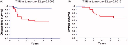 Figure 4. Disease free survival (A) and overall survival (B) curves according to tumor–stroma ratio (TSR) in the surgically resected tumor. Upper curves represent patients with a high TSR (stroma low, N = 33) and lower curves patients with a low TSR (stroma high, N = 29).