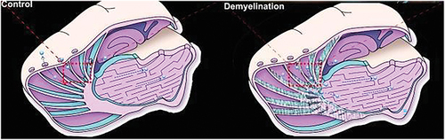 Figure 2. Different ISF drainage routes in normal rats and demyelinated rats. Briefly, in healthy rats, the obstruction of the myelinated fiber tracts is compact, and ISF from the caudate nucleus (Cn) could not drain to the ECS of the thalamus (Tha) and vice versa. However, in the demyelinated rats, myelinated fiber tracts are loose, which makes ISF from the caudate nucleus drain to the thalamus and a small quantity of ISF from the thalamus drain to the caudate nucleus [Citation97].