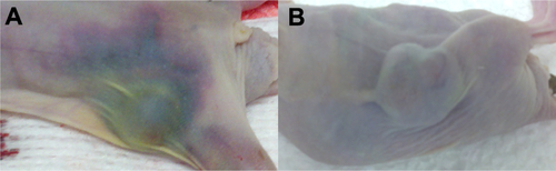 Figure S3 Hematoma around the tumors of mice injected with PTX alone. Representative images are shown for mice injected with PTX alone (A) and J591-SPMs (B) taken post-mortem. The mice injected with PTX alone clearly had extensive hematoma around the tumors and all along the right flanks, whereas the mice injected with J591-SPMs did not have this side effect, suggesting that in addition to targeting the drug, encapsulation of the drug also reduced side effects.