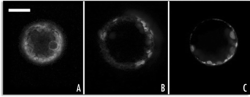 Figure 8 Representative fluorescent pattern of SP1-GFP variants. (A) SP1-GFPKDEL remained distributed within the ER; (B) SP1-GFPChi pattern was similar to SP1-GFP with no signal, peripheral ER and small compartments were labelled; (C) SP1-AleuGFP was mostly visible in small compartments similar to prevacuoles. Scale bar = 20 µ.