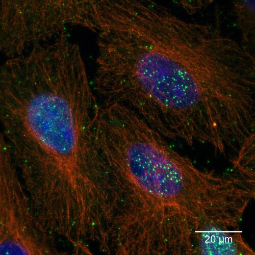 Figure 1. VSBV-1 isolate “Alvin” on Vero cells. Bornavirus specific nuclear and cytoplasmic dots (green); cytoplasmic microtubuli (red) and nuclear chromatin (blue). Maximum-z-projection of three confocal slices acquired at a z-step size of 0.35 µm.