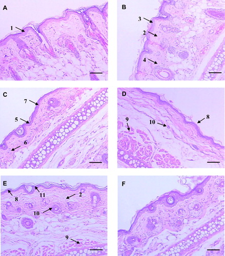 Figure 1. Histopathological analysis of ear tissue, H&E. Scale bars: 100 µm. (A) Control: normal histology of rat ear tissue with the absence of inflammatory infiltrate and edema. Basal layer and epidermal cell maturation preserved (1). (B) NiSO4 sensitized; contact dermatitis characteristics such as dermal edema (2), acanthotic Malpighian layer (3) and moderate lymphocytic infiltrate (4). (C) NiSO4 sensitized and treatment with free clobetasol; shortening of the cornea and thickness of the granulomatous layer (5), decrease of lymphocytic infiltrate (6), and Malpighian layer atrophy (7). (D) NiSO4 sensitized and daily treatment with nanostructured clobetasol; Malpighian layer (8), muscular (9) and fur atrophy (10). (E) NiSO4 sensitized and alternately treated with clobetasol (days 1, 3, and 5); Malpighian layer (8), muscular (9) and fur atrophy (10), desquamation of the cornea layer (11) and edema (2). (F) Nanoparticles treatment: absence of atrophy.