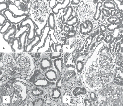 Figure 1. Masson's trichrome stained histological sections of renal cortex of rats from dams submitted to high-sodium intake (B and D) and of the same age control rats (A and C) at 120 days after nephrectomy (C and D) or a sham operation (A and B), × 280.