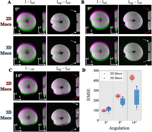 Figure 7. Influence of motion correction in presence of out of plane motion. Experimental data with a multiband acceleration of 2 obtained on a moving agar gel phantom with the angulation of 0° (A), 8°(B), 14°(C) between the imaging plane and the main direction of the motion. For each, two different registration workflows 2D (top) versus 3D (bottom) are compared by showing the difference between the current image and the reference image before (I–Iref) and after registration (Ireg–Iref). The difference is overlaid on the magnitude image using a color code (green-pink). The white and red arrows indicate the absence or the existence of residual misalignments, respectively, close to the electrode or at the border of the gel. RMSE computed over 60 repetitions between the registered images and a reference image are shown (panel D) in a box and whisker plot for 3 different acquisitions on a moving agar gel phantom with an angulation of 0°, 8°, 14°. For each, the 2 different registration workflow 2D (red) versus 3D (blue) are compared.