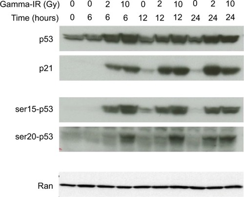 Figure 2 Time course of p53 activation in TK6 cells by IR. TK6 cells were either sham treated or exposed to 2Gy or 10Gy, and then incubated for the indicated lengths of time. Lysates were immunoblotted with antibodies recognizing either total p53 or phospho-specific p53 isoforms, as well as p21. Ran was probed as a loading control.