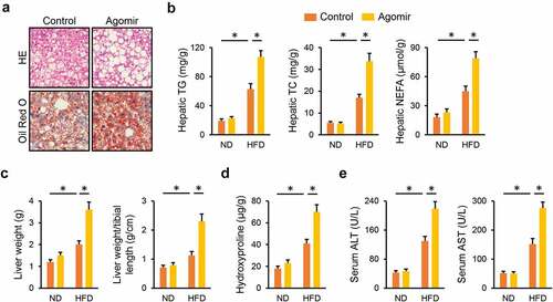 Figure 3. miR-665-3p agomir facilitates NAFLD progression in mice. (a) HE and oil red O staining of liver tissues. (b) Hepatic levels of TG, TC and NEFA. (c) Quantification of the liver weight and liver weight/tibial length. (d) Hepatic hydroxyproline levels. (e) Serum ALT and AST levels. All results were expressed as the means ± standard deviations, n = 6 for each group, and *P < 0.05 was considered statistically significant.