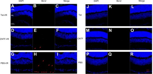 Figure 10 Tet and CNTF inhibited Bcl-2 expression 1 day after I/R insult.