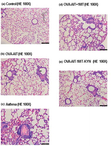 Figure 2. Representative histological images of the indoleamine 2,3 dioxygenase (IDO) inhibitor, 1-methyl tryptophan (1-MT), and the tryptophan metabolite, kynurenine (KYN), on the allergen-specific immunotherapy (AIT). Representative lung sections stained with hematoxylin and eosin (H&E) from the indicated group: (a) control, (b) treated with ovalbumin (OVA) plus AIT, (c) asthma, (d) stimulated with OVA + AIT then 1-MT, (e) stimulated with OVA + AIT, then 1-MT + KYN. Data represent mean ± SEM of 2 independent experiments with n ≥ 3 mice per experiment.