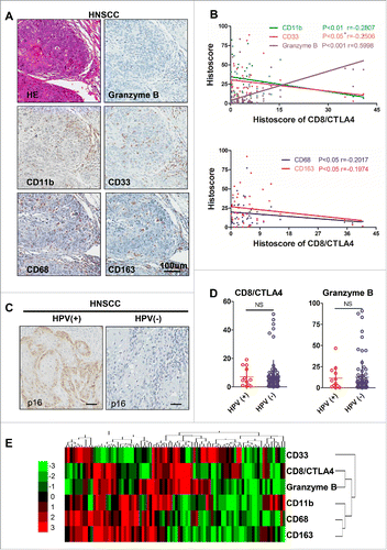Figure 2. CD8+/CTLA4 protein expression ratio is correlated with immature suppressive myeloid cells in HNSCC. (A) Representative pictures of hematoxylin and eosin (HE) staining and immunohistochemical staining for Granzyme B, CD11b, CD33, CD68 and CD163 in HNSCC serial section. Scale bar, 100 μm. (B) The protein expression histoscore of CD8+/CTLA4 ratio exhibits a positive correlation with Granzyme B and a negative correlation with CD11b, CD33, CD68 and CD163 in HNSCC. (C) Representative immunohistochemistry staining of p16 to identify HPV-positive and HPV-negative HNSCC. Scale bar, 50 μm. (D) Quantification the CD8+/CTLA4 ratio and Granzyme B histoscore of HPV-positive and HPV-negative in HNSCC. NS, No Significant. (E) Hierarchical clustering of CD8+/CTLA4 ratio, CD11b, CD33, CD68, CD163, and Granzyme B histoscore results in human HNSCC.