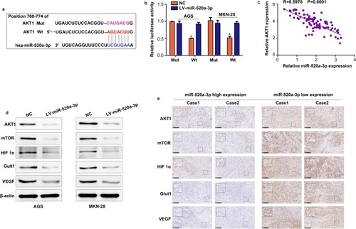 Figure 5 AKT1 is a vital target of miR-520a-3p in GC. (A) miR-520a-3p may bind to the 3ʹ-UTR of AKT1 mRNA. (B) miR-520a-3p mimics inhibited the luciferase activity in GC cells, while mutation of the associating element in 3′-UTR of AKT1 mRNA abolished the effect of the miR-520a-3p mimic on luciferase activity. (C) The expression of miR-520a-3p was inversely associated with that of AKT1 in GC tissues. (D) Western blotting was used to detect the expression of AKT1, mTOR, HIF1α, VEGF, and Glut1 in the miR-520a-3p-overexpressing group and control group. (E) The expression of AKT1, mTOR, HIF1α, VEGF, and Glut1 in miR-520a-3p high and low expression GC tissues (200× and 400×). *P<0.05.Abbreviations: AKT1, AKT serine/threonine kinase 1; GC, gastric cancer; 3ʹ-UTR, 3ʹuntranslated region; mTOR, mechanistic target of rapamycin kinase; HIF1α, hypoxia inducible factor 1 subunit alpha; VEGF, vascular endothelial growth factor; Glut1, Glucose transporter 1; ECAR, extracellular acidification rate; OCR, cellular oxygen consumption rate; ATP, adenosine triphosphate.