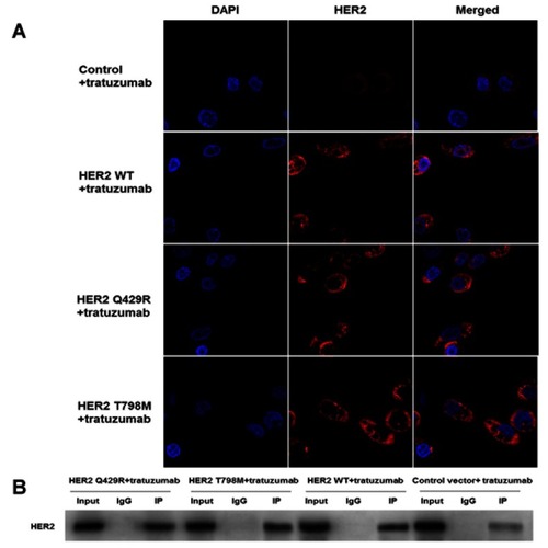 Figure 4 The mutation of HER2 almost had no influence on the expression of HER2 and the interaction of HER2 and trastuzumab. (A) The expression of HER2 (red) was examined by immunofluorescence analysis with a confocal microscope. Up-regulations of HER2 were detected in HER2 WT cells and the mutant-expressing cells when compared with the control group. However, there were no significant differences in the expression of HER2 between the HER2 WT cells and the mutant-expressing cells. DAPI, a blue tint to the nucleus. The photographs were taken at a magnification of x200. (B) Co-immunoprecipitation (IP) was carried out to confirm the physical interaction of HER2 and trastuzumab. Immuno-reactive signals of HER2 and trastuzumab were clearly detected in the immune-precipitates of anti-HER2. The cell lysate was immunoprecipitated and subjected to Western blot to detect HER2. The representative result is shown from three repeats with a similar pattern.