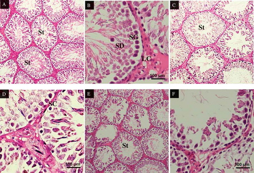 Figure 5. Testicular cross sections of rats, stained with H&E. (A) Testis section of control group (NC), showing normal histological structure of seminiferous tubules (St) containing spermatocytes and late spermatids in the lumen, X100. (B) At higher magnification, the seminiferous epithelium consisting of spermatogonia (SG), spermatocytes and spermatids (SD) can be observed clearly, X400. (C) The effect of MSG treatment at 60 mg/kg is not significant as the normal histostructure of the testis is not disturbed, X100. (D) The seminiferous epithelium is also well intact, X400. (E) However, at the dose of 120 mg/kg, MSG treatment caused deformation to the seminiferous tubules, where some of the seminiferous tubules showed atrophied epithelium layer, X100. (F) At higher magnification, the damage is even more obvious with the loss of spermatocytes and thinning of the epithelium layer, X400.