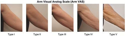 Figure 1 Arm Visual Analog Scale for aging of the upper arms developed using the image bank from the current study.