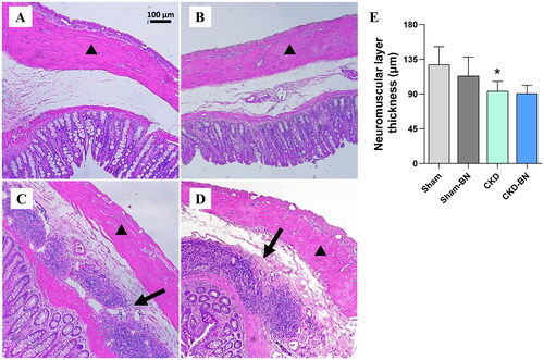 Figure 3. Representative photomicrographs of the colonic tissue [a, b, c, d] and colon neuromuscular layer thickness [e] of experimental groups. The Sham and Sham-BN groups presented preserved parenchyma [a, b]. In contrast, the CKD and CKD-BN group exhibited inflammatory foci between the mucosal and submucosal layers (indicated by the arrow) [c, d]. The arrowhead indicates the neuromuscular layer. Hematoxylin and eosin, 10× magnification. (*) means statistical difference compared to the Sham group (p = 0.0375). Statistical significance was considered when p < 0.05. One-way ANOVA with Sidak post-test. [e] Sham, n = 5; Sham-BN, n = 5; CKD: n = 5; CKD-BN: n = 4.