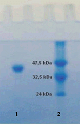 Figure 2.  Elutiongraph of paraoxonase 1 from human serum by Sephadex G-200 gel filtration chromatography. Fractions from the diethylaminoethyl cellulose-Sephadex column were mixed with glycerol and loaded onto the Sephadex G-200 column (60 cm × 2 cm),which had been equilibrated with 100 mM Na-phosphatebuffer (pH7.0). Elution was performed with the same buffer. Fractions were analyzed for both protein amount (280 nm) and enzyme activity (412 nm).