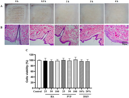 Figure 4. In vivo skin insertion and safety evaluation of MTX-loaded DMNPs. Skin recovery images (A) and H&E staining of inserted skin sections (B) at 0, 0.5 h, 1 h, 3 h, and 6 h after DMNPs treatment. (C) MTT assay of blank DMNPs and materials which constituted DMNPs solution at different concentrations for 48 h (Mean ± SD, n = 5).