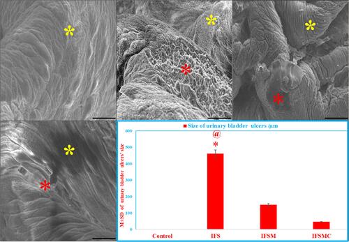 Figure 6 Mesna and MCC effects on the UB ultrastructure of IFS-induced HC. The control and IFSMC groups reveal normal UB surface transitional epithelium (yellow *). In contrast, the IFS group shows significant increases in the area percentage of ulcerated mucosa (red *), which is minimally reduced in the IFSM group. SEM; 700x, bar = 30 µm. Statistical analysis of the area percentage of UB ulcers in all groups. *P<0.05 vs the control and @P<0.05 vs the IFSMC group.