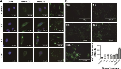 Figure 6 The effect of ZnO NPs on the autophagy process in BV-2 cells.Notes: (A) After the wild-type BV-2 cells were transfected with the GFP-LC3 plasmid, they were treated with 10 μg/mL ZnO NPs for 4, 8, 12, and 24 h. The autophagy process was evaluated using a fluorescence microscope. (B) After the cells were treated with 10 μg/mL ZnO NPs for 4, 8, 12, and 24 h, they were dyed with MDC, and then the fluorescence was determined using a fluorescence microscope. Cells treated with rapamycin (100 nM/L) for 2 h were used as a positive control. (C, D) After the cells were treated with 10 μg/mL ZnO NPs for 4, 8, 12, and 24 h, they were harvested; the total protein was extracted, and the autophagy process was evaluated using Western blot analysis. (E) The autophagy process was examined by TEM. The blue arrows show autophagosomes, and the red arrows show the mitochondria. Compared with the control, the swelling of mitochondria and an increasing number of autophagosomes were observed in the experimental groups. *P<0.05, **P<0.01, ***P<0.001 represent comparing the time point after NPs treatment with control.Abbreviations: ZnO NP, zinc oxide nanoparticle; MDC, dansylcadaverine; TEM, transmission electron microscopy.