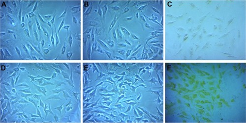 Figure 8 Bright field microscopic images of normal human osteoblast cells: (A) control, (B) treated with 20 μM of curcumin in phosphate-buffered saline, and (C) treated with 20 μM of curcumin encapsulated by amphiphilic nanoparticles. Bright field microscopic images of osteosarcoma cells: (D) control, (E) treated with 20 μM of curcumin in phosphate-buffered saline, and (F) treated with 20 μM of curcumin encapsulated by amphiphilic nanoparticles. Images were taken at a magnification of 20×.