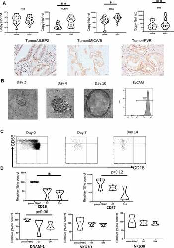 Figure 6. The PDAC tumor microenvironment expresses high levels of NK cell ligands and tumors induce downregulation of CD16 and CD57 on NK cells