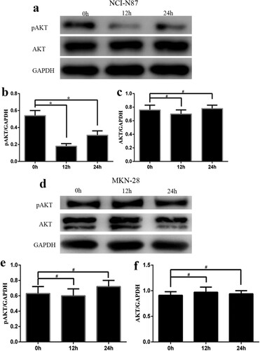 Figure 5. Protein levels of pAkt and Akt in the NCI-N87 and MKN-28 cell lines after treatment with trastuzumab and epirubicin at 3 time points (0, 12, and 24 h). (a) Western blot assay of pAkt and Akt in the NCI-N87 cell line. The bar graph reflects the levels of pAkt (b) and Akt (c) in the NCI-N87 cell line. (d) Western blot assay of pAkt and Akt in the MKN-28 cell line. The bar graph reflects the levels of pAkt (e) and Akt (f) in the MKN-28 cell line. Statistically significant differences between the two groups are shown with an asterisk (∗p < 0.05).