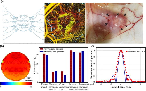 Figure 15. Validation of the present model; (a) A qualitative comparison of angiogenesis modeling in agreement with in vivo observations (Vakoc et al., Citation2009; Roudnicky et al., Citation2018) shows that the new vessels near the tumor border and inside the tumor have many branches and loops (Middle figure from (Vakoc et al., Citation2009), Right figure from (Roudnicky et al., Citation2018)). (b) A comparison of intravascular and interstitial pressure in agreement with different tumors in real models (Stylianopoulos et al., Citation2018) indicates their high pressure and low difference. (c) The spatial distribution of the normalized acoustic pressure for the single transducer of the present model in agreement with the experimental model (Solovchuk et al., Citation2012) shows that the maximum acoustic pressure is recorded at the focal point.