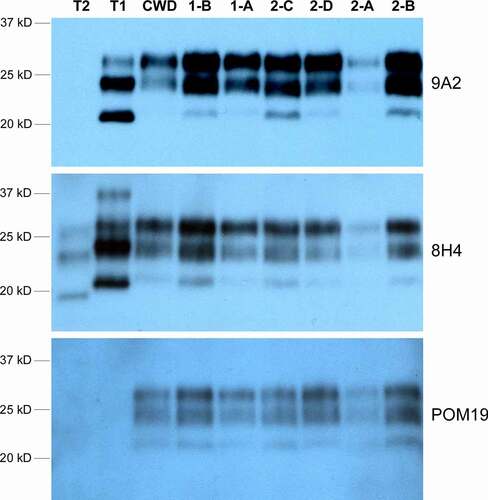 Figure 2. Western blot of CWD PrPRES in the brain tissues from Sites 1 and 2 elk. Four anti-PrP antibodies that target different PrP epitopes were used: 9A2 (epitope 97–115), 8H4 (epitope 177–180), and POM19 (epitope 201–225). POM19 does not recognize human PrP whereas 9A2 shows higher affinity for type 1 PrPRES. T1 and T2 are type 1 sCJD and type 2 sCJD human brain tissue controls, respectively. ‘CWD’ is a positive control elk CWD brain sample from an unrelated study. The loading amount was adjusted between the brain samples to allow more comparable signal strength for all samples with the same exposure: 5ul of 5% brain homogenate for 1-B, 1-A, 2-C and 2-A; 2ul of 5% brain homogenate for 2-D, 2-B and the control ‘CWD’ samples; 30ul of 5% brain homogenate for T1 and T2 human sCJD controls. The difference in sample loading volume was made up with 5% brain homogenate from PrPKO/FVB mice