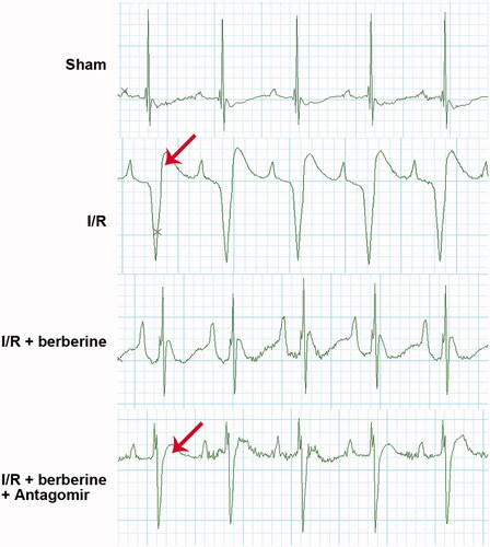 Figure 6. Berberine improved ECG pattern in I/R rats by inducing the level of miR-26b-5p. Arrow indicates the elevated ST segment of ECG.
