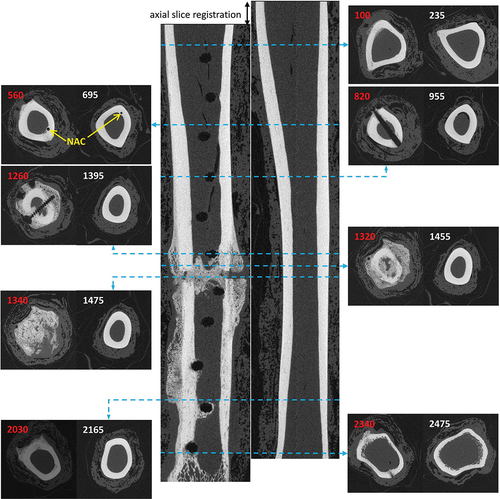 Figure 1. Quantitative analysis of remodelling in an operated ovine tibia relative to the intact contralateral tibia from the same animal required axial registration of µCT slices from two separate scans. Scans were aligned by matching the level of the nutrient artery canal (annotated NAC) in the two scans. In this example animal, the axial offset is hoff = 135 slices. Numbers on each image refer to the slice position in image stack, with white text for intact and red text for operated.