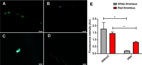 Figure 6 Receptor-specific binding studies and blocking studies observed by inverted fluorescence microscopy after fluorescence staining of GPIIb/IIIa and P-selectin.Notes: Panels (A) and (B) respectively show activated platelets in white thrombus without/after pre-incubation with DDNPs. Panels (C) and (D) show activated platelets in red thrombus without/after pre-incubation with DDNPs. (E) Quantitative analysis of the fluorescence intensity. The fluorescence intensity without and after pre-incubation with DDNPs is different, indicating that the nanoparticles can bind to specific targets in the thrombus, especially in the white thrombus. (Scale bar: 100 μm) (*P<0.05).Abbreviation: DDNPs, dual-modality and dual-ligand nanoparticles.
