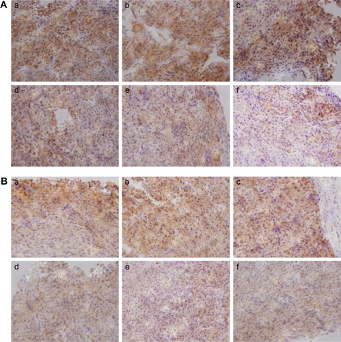 Figure 5 Expression of VEGF and HIF-1α by immunohistochemistry.Notes: Expression of VEGF (A) and HIF-1α (B) in tumor xenograft among mice that received different treatments. Saline (a), PLCP (b), PLCP/Scr siRNA (c), PLCP/VEGF siRNA (d), DOX (e), and PLCP/VEGF siRNA + DOX (f).Abbreviations: DOX, doxorubicin; HIF-1α, hypoxia-inducible factor-1α; PLCP, polycation liposome-encapsulated calcium phosphate nanoparticles; Scr, scramble; siRNA, small interfering RNA.