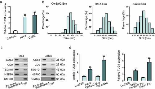 Figure 1. The obvious expression level of TUG1 was observed in CC cell lines and their secreted exosomes. (a). qRT-PCR examined the expression of TUG1 expression in CC cell lines (HeLa, CaSki) and human cervical epithelial cells (CerEpiC). (b). Nanoparticle tracking analysis was applied for the size distribution of HeLa-Exo, CaSki-Exo and CerEpiC-Exo (the cells were cultivated in the medium for 48 h. 1 × 109 exosomes were isolated from CerEpiC, HeLa, or CaSki cell supernatant). (c). Western blot analysis illustrated the expression situation of exosomal markers in exosomes derived from HeLa and CaSki. GM130, the total cellular protein marker, served as control. (d). The expression of TUG1 in CC cell lines and their secreted exosomes was detected by qRT-PCR. Data are exhibited as mean ± standard deviation (S.D.; n ≥ 3), **P < .01.